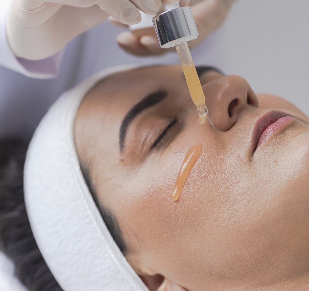 peeling clareador