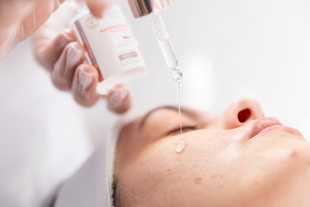 Peelings para acne