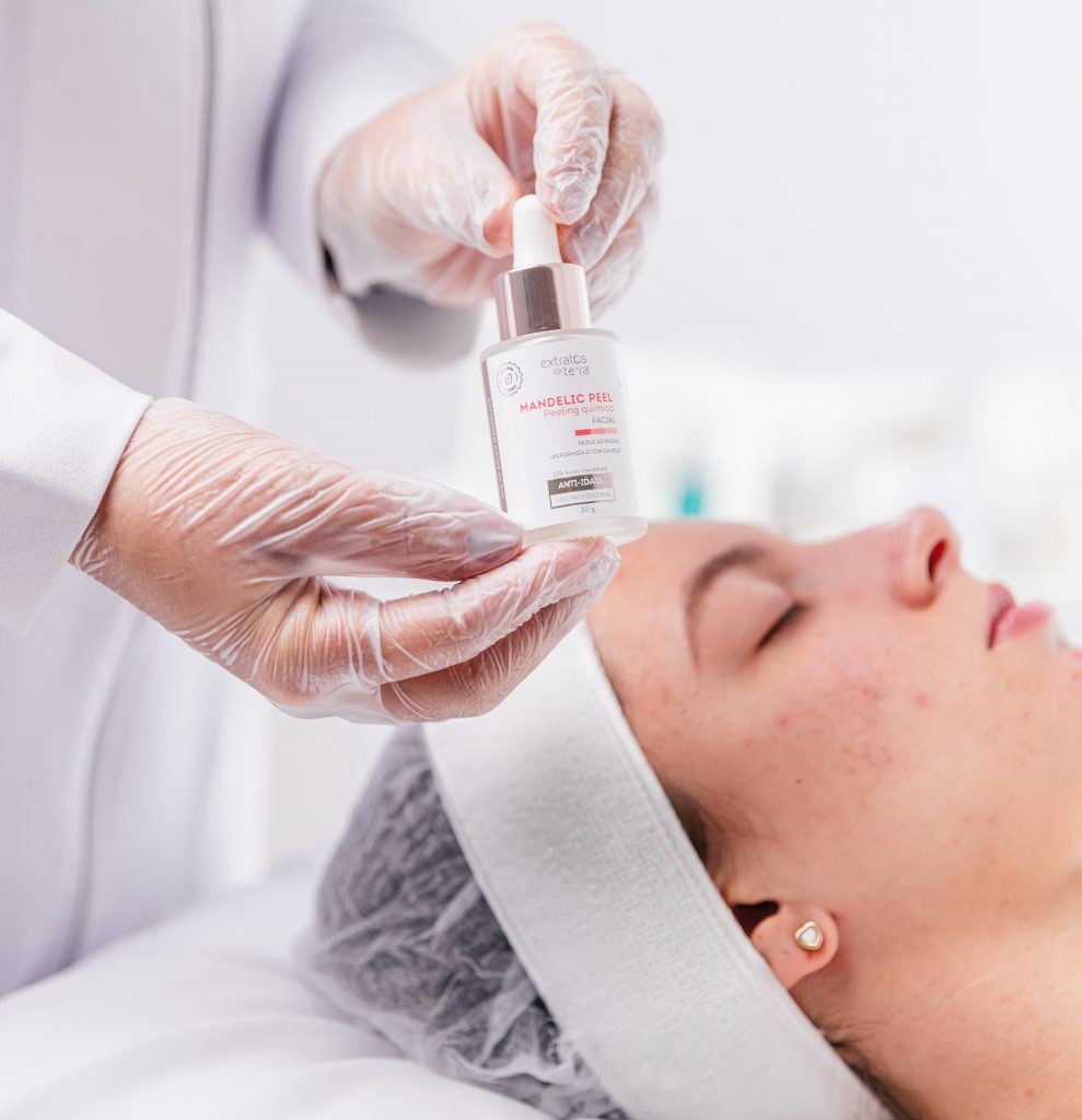Peeling químico para tratamento da acne