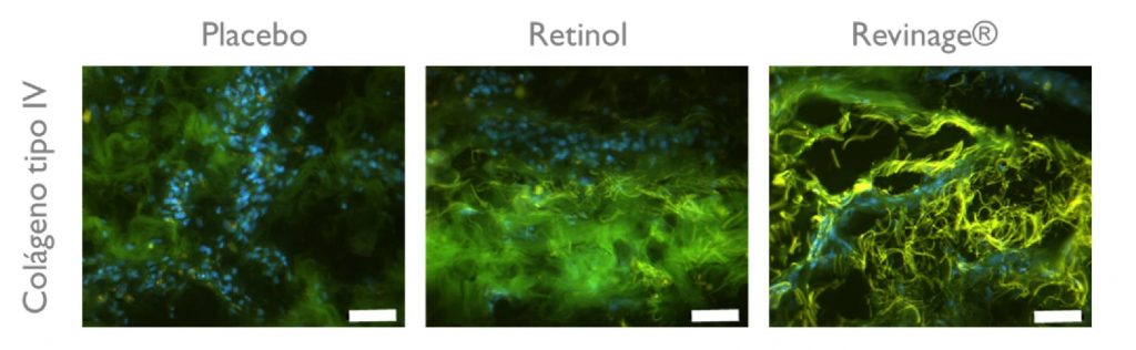 Aumento do colágeno IV do retinol e revinage